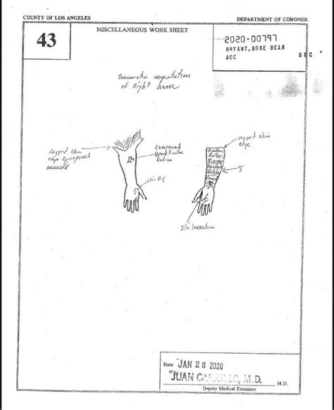 gigis autopsy report|File : Gianna Bryants autopsy report (2020).pdf